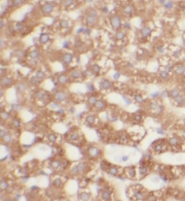 UGT2B4 antibody|UGT2B4抗体