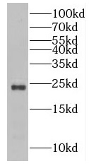 RAB43 antibody|RAB43抗体