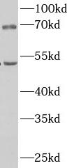 CPN1 antibody|CPN1抗体 FNab09983