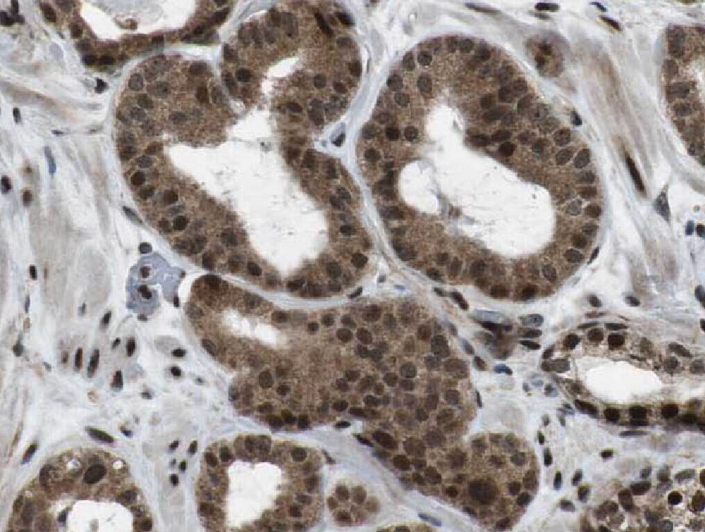 WBP2NL antibody|WBP2NL抗体