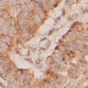 MGMT antibody|MGMT抗体 FNab10100