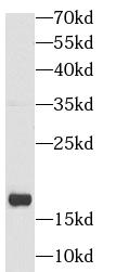 SNCA antibody|SNCA抗体 FNab09891