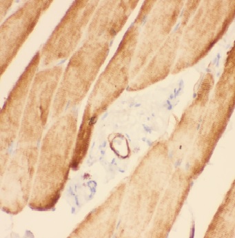 ADAMTSL4 antibody|ADAMTSL4抗体