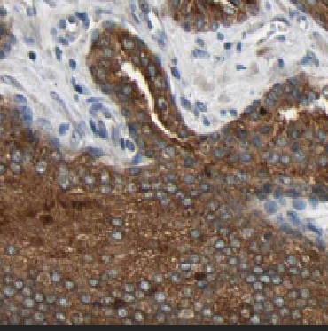 CYP4F8 antibody|CYP4F8抗体