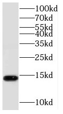 SCP2 antibody|SCP2抗体 FNab07654