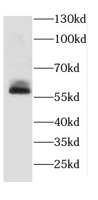 CTSA antibody|CTSA抗体