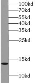 DMRTC1 antibody|DMRTC1抗体