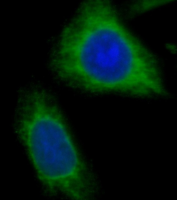 NDUFB8 antibody|NDUFB8抗体