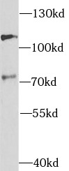 TAU antibody|TAU抗体 FNab08505