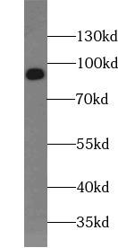 DVL2 antibody|DVL2抗体