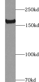TUT7 antibody|TUT7抗体