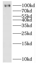 HECTD3 antibody|HECTD3抗体