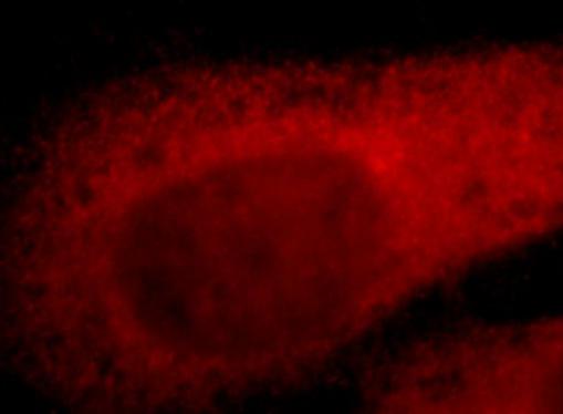 TYMS antibody|TYMS抗体