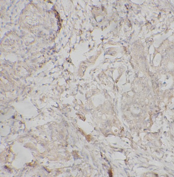 EZH2 antibody|EZH2抗体 FNab10174