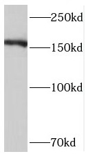 STAG1 antibody|STAG1抗体
