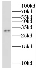 NUBP2 antibody|NUBP2抗体