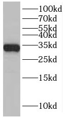 SLC25A22 antibody|SLC25A22抗体