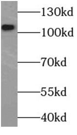 C3/C3b/C3c antibody|C3/C3b/C3c
