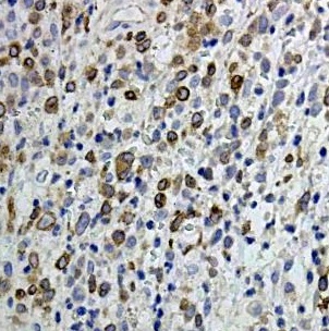 BCL3 antibody|BCL3抗体