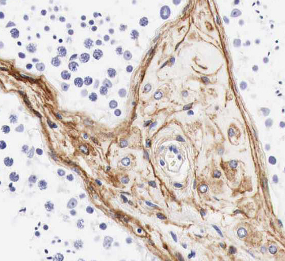 ROPN1L antibody|ROPN1L抗体