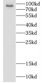 COG7 antibody|COG7抗体