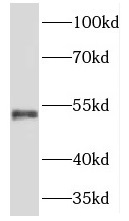 TMCO6 antibody|TMCO6抗体