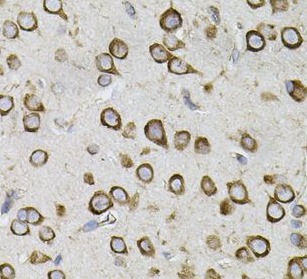 CEP164 antibody|CEP164抗体