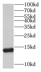 SNRPD3 antibody|SNRPD3抗体