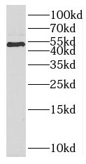 PARD6B antibody|PARD6B抗体
