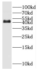 POU3F4 antibody|POU3F4抗体
