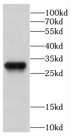 CAPZB antibody|CAPZB抗体