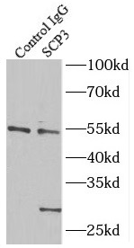 RNASEH2C antibody|RNASEH2C抗体