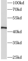 APOA4 antibody|APOA4抗体 FNab004