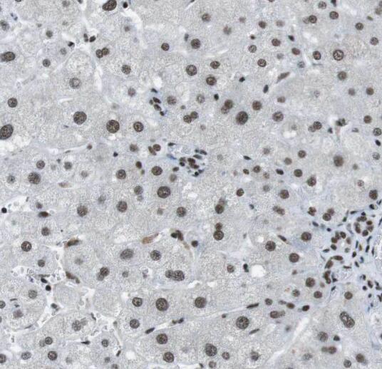 RPL23A antibody|RPL23A抗体