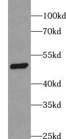 ZNF597 antibody|ZNF597抗体