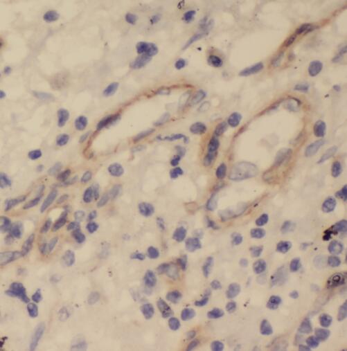 STOML2 antibody|STOML2抗体 FNab0