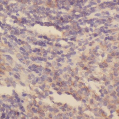 SKAP1 antibody|SKAP1抗体 FNab078
