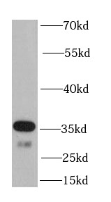 OGG1 antibody|OGG1抗体