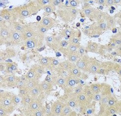 COTL1 antibody|COTL1抗体 FNab018