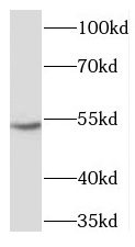 XIAP antibody|XIAP抗体 FNab09541