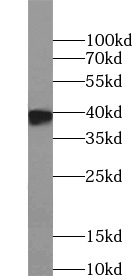 MYC-tag antibody|MYC-tag抗体 FNa