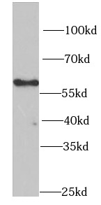 PNKP antibody|PNKP抗体