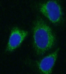 ALDH1B1 antibody|ALDH1B1抗体 FNa