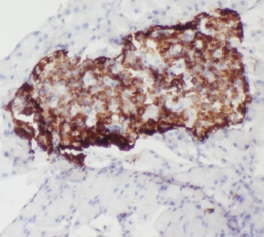 IAPP antibody|IAPP抗体