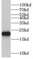 TRAPPC4 antibody|TRAPPC4抗体