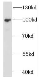 EXOSC10 antibody|EXOSC10抗体 FNa