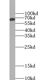CHAT antibody|CHAT抗体 FNab01631