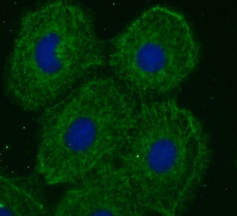 TOR1AIP2 antibody|TOR1AIP2抗体