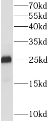 IL1F10 antibody|IL1F10抗体