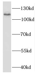 EXOC6 antibody|EXOC6抗体
